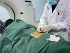 李先生、男、35、腰45椎间盘突出(中央型)